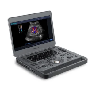 X3Pro – Aparelho de Ultrassom Portátil para Diagnóstico por Imagem – SonoScape